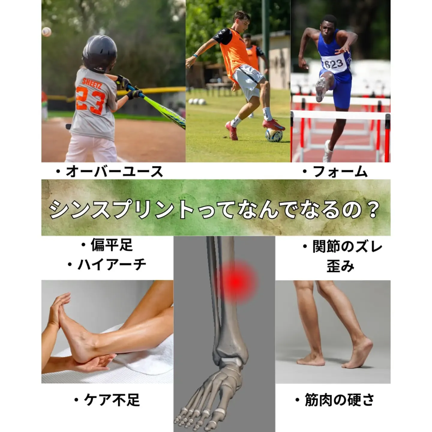 🏃‍♂️【足首くんが解説！シンスプリントってなに？】