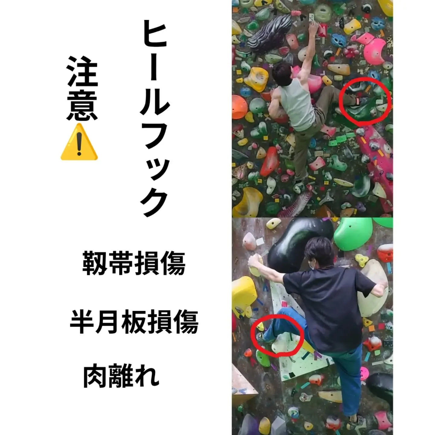 【ボルダリングの方、必見!】ヒールフックで膝が痛い…そんな方...