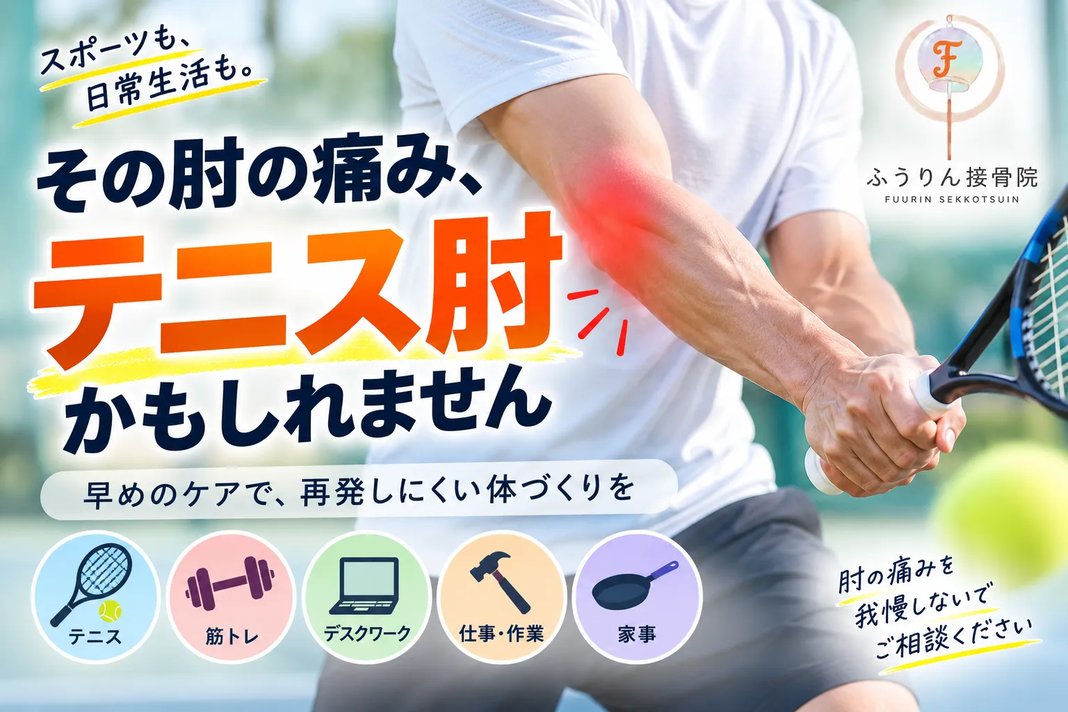 「テニス肘はなぜ治りにくい？原因・セルフチェック・改善のポイントを接骨院が解説」