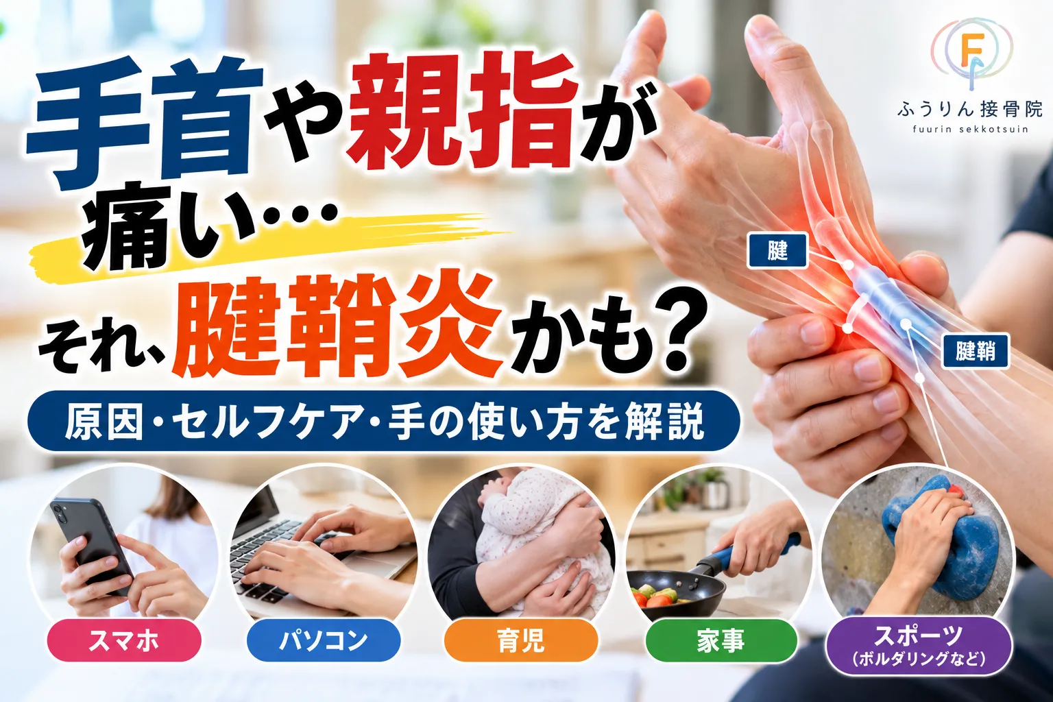 【手首や親指が痛い…それ腱鞘炎かも？原因・セルフケア・手の使い方を解説】