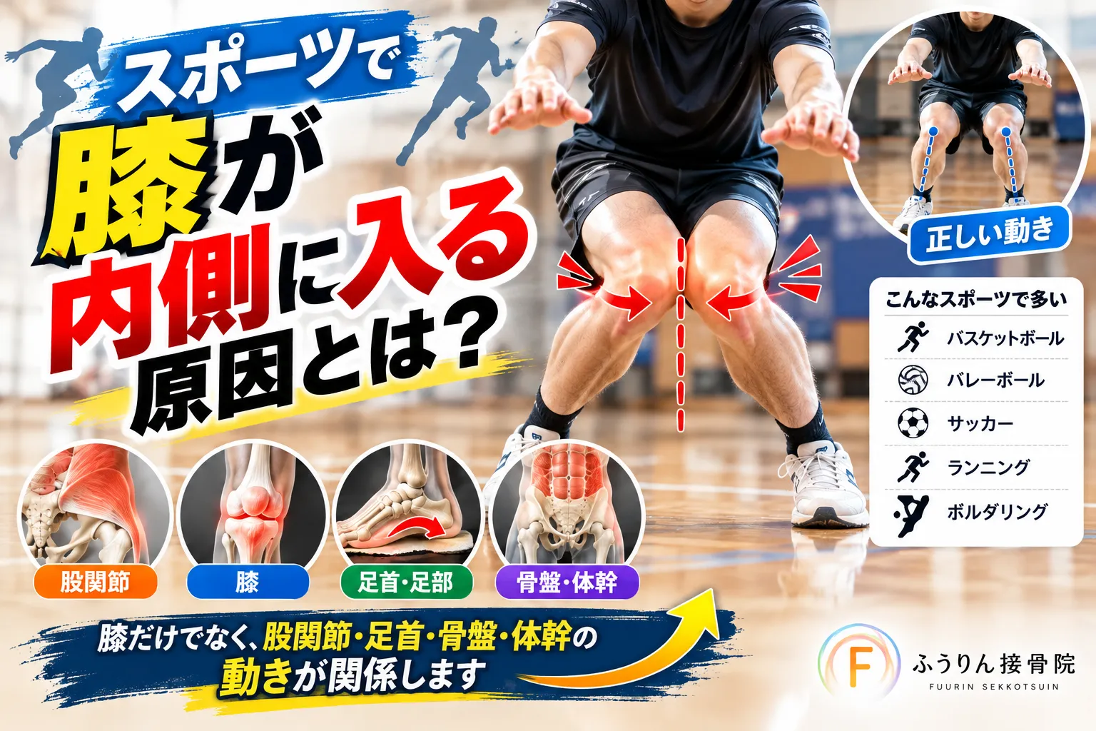 【スポーツで膝が内側に入る原因とは？ニーインと股関節・足首・体幹の関係を徹底解説｜豊川市のふうりん接骨院】