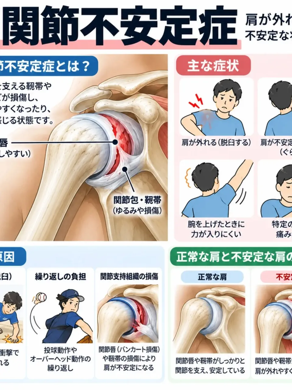 【肩の痛み、原因は一つではありません】
